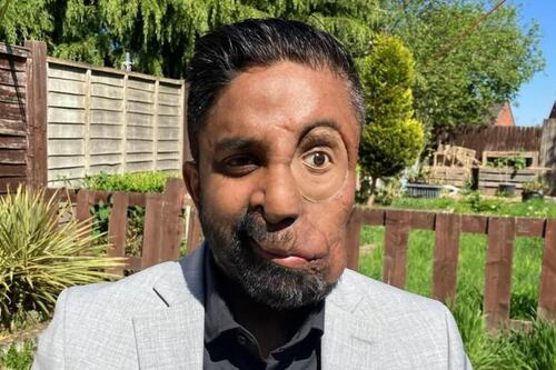 “Se negaron a atenderme en un café por mi cara”